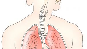 Рак легких: этапы развития и варианты лечения