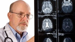 Предынсультное состояние: как распознать первые признаки