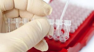 Около 80 % случаев ВИЧ приходится на Восточную Европу. Россия – лидер