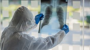 Коронавирус в России: ВОЗ удивлена низкими показателями смертности при огромном количестве заражений