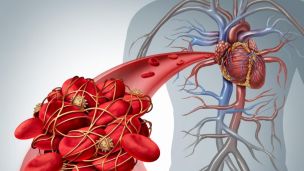 10 признаков густой крови: проверьте себя сами