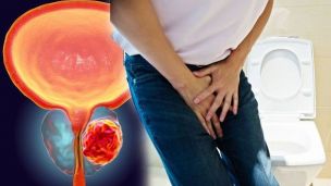 Симптомы рака простаты