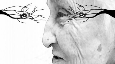 Новый препарат для диагностики болезни Альцгеймера