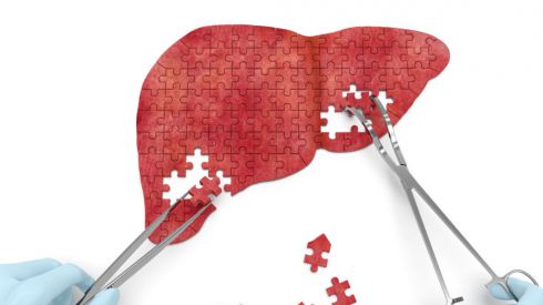 Уровень заболеваемости гепатитом А начал расти впервые за 15 лет