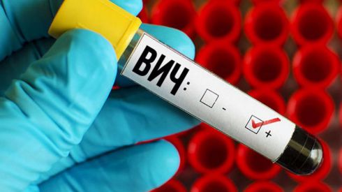 Разработан вагинальный имплантат, защищающий женщин от ВИЧ