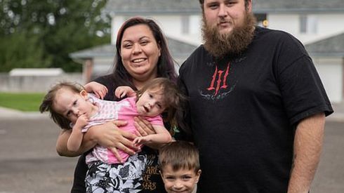 Сиамские близнецы, которые, по прогнозам врачей, могли прожить лишь сутки, отпразднуют двухлетие (ФОТО, ВИДЕО)