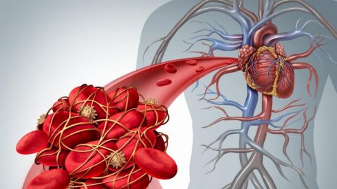 10 признаков густой крови: проверьте себя сами