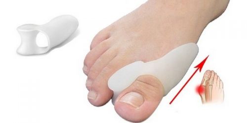 Вальгусный корректор