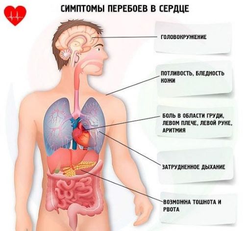 Симптомы сердечного приступа